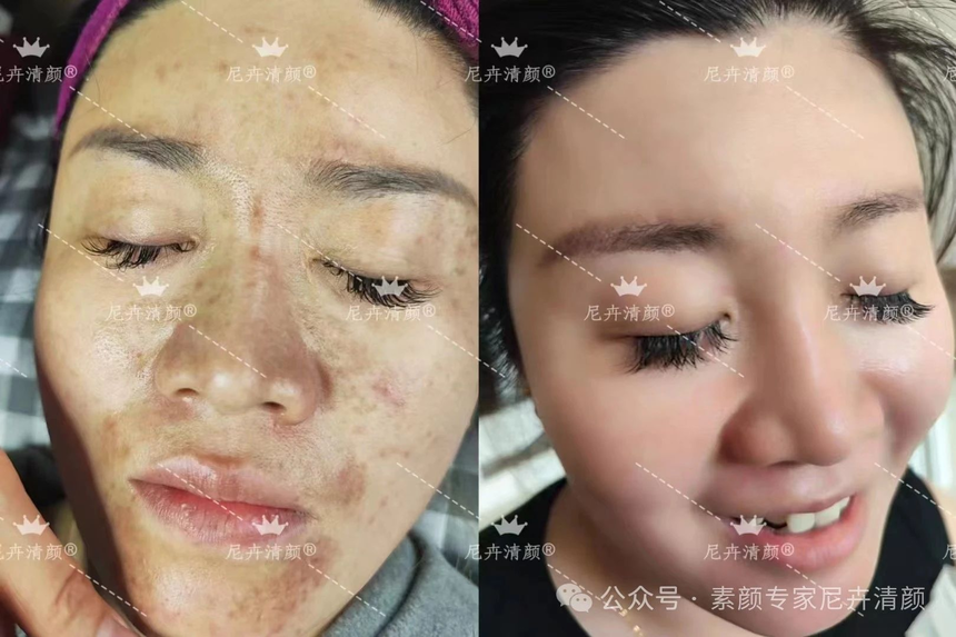 1746684573257437.png 1730258796125114.png